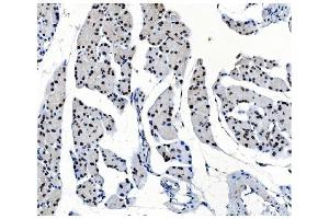 IHC analysis of OGT using anti-OGT antibody (ABIN3043893).