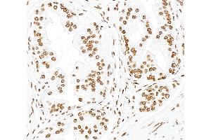 Immunohistochemistry (IHC) image for anti-Tumor Protein P53 Binding Protein 1 (TP53BP1) (AA 350-400) antibody (ABIN7453568)