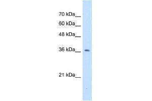 NUDT9 antibody used at 1 ug/ml to detect target protein. (NUDT9 Antikörper)
