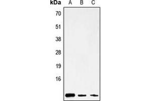 Western blot analysis of ATP8 expression in HepG2 (A), mouse brain (B), rat stomach (C) whole cell lysates. (Mitochondrially Encoded ATP Synthase 8 (MT-ATP8) (Center) Antikörper)