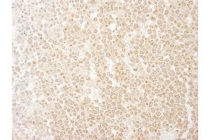 anti-Kinesin Family Member 2C (KIF2C) (AA 50-100) antibody