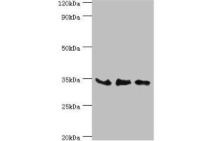 Western blot All lanes: SRM antibody at 8 μg/mL Lane 1: PC-3 whole cell lysate Lane 2: Hela whole cell lysate Lane 3: HepG2 whole cell lysate Secondary Goat polyclonal to rabbit IgG at 1/10000 dilution Predicted band size: 34 kDa Observed band size: 34 kDa (Spermidine Synthase Antikörper  (AA 1-302))