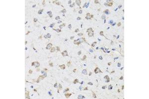 Immunohistochemistry of paraffin-embedded mouse brain using USP25 antibody at dilution of 1:100 (x40 lens).