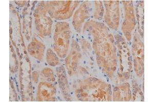 ABIN6267334 at 1/200 staining Human kidney tissue sections by IHC-P.