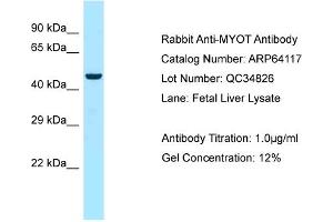 Western Blotting (WB) image for anti-Myotilin (MYOT) (C-Term) antibody (ABIN2789737)