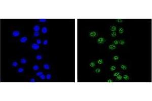 Confocal immunofluorescent analysis of Nibrin Antibody (C-term) Cat. (Nibrin Antikörper  (C-Term))