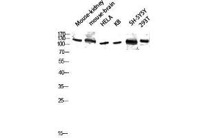 Western Blot (WB) analysis of Mouse Kidney Mouse Brain HeLa KB SH-SY5Y 293T lysis using GCP5 antibody. (TUBGCP5 Antikörper  (Internal Region))