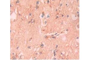 DAB staining on IHC-P;Samples:Human Brain Tissue. (APOA5 Antikörper  (AA 167-335))