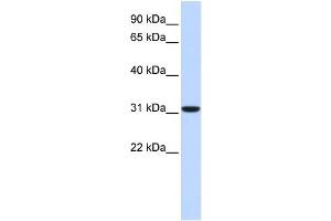 WB Suggested Anti-CA8 Antibody Titration:  0. (CA8 Antikörper  (Middle Region))