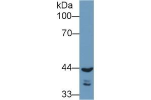Detection of REV1 in Human A549 cell lysate using Polyclonal Antibody to REV1 Homolog (REV1) (REV1 Antikörper  (AA 301-478))