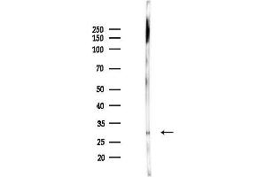 anti-Non-SMC Element 1 Homolog (NSMCE1) antibody