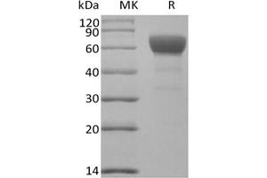 Western Blotting (WB) image for Transforming Growth Factor, beta Receptor II (70/80kDa) (TGFBR2) protein (Fc Tag) (ABIN7320900) (TGFBR2 Protein (Fc Tag))