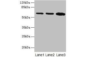Western blot All lanes: SPTLC2 antibody at 12 μg/mL Lane 1: HepG2 whole cell lysate Lane 2: A549 whole cell lysate Lane 3: HT29 whole cell lysate Secondary Goat polyclonal to rabbit IgG at 1/10000 dilution Predicted band size: 63 kDa Observed band size: 63 kDa