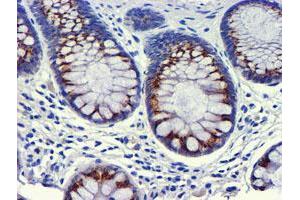 Immunohistochemical staining of paraffin-embedded Human colon tissue using anti-GOLM1 mouse monoclonal antibody. (GOLM1 Antikörper)
