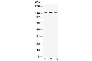 Western blot testing of 1) rat thymus, 2) mouse thymus and 3) MCF7 lysate with CIITA antibody at 0. (CIITA Antikörper)