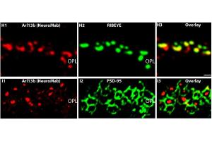 Spinning disc confocal image identifying localization of the atypical GTPase protein ARL13B (Cat (ABIN1304543), red) in primary cilium, marked by acetylated tubulin (green), in Aquaporin 2 (magenta) positive renal collecting ducts in a 24-day old mouse. (ARL13B Antikörper  (C-Term))