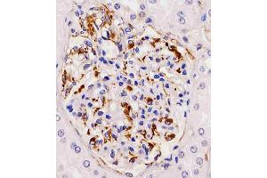 Antibody staining RHBDF2 in human kidney tissue sections by Immunohistochemistry (IHC-P - paraformaldehyde-fixed, paraffin-embedded sections). (RHBDF2 Antikörper  (N-Term))