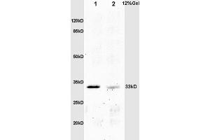 L1 mouse embryo lysates L2 mouse intestine lysates probed with Anti phospho-Crkl(Tyr251) Polyclonal Antibody, Unconjugated (ABIN703420) at 1:200 overnight at 4 °C. (CrkL Antikörper  (pTyr251))
