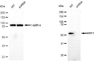 Western blotting analysis using keratin 7 antibody (ABIN7799187). (Rekombinanter Cytokeratin 7 Antikörper)