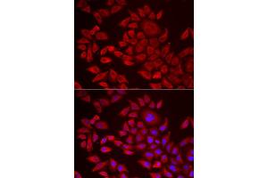 Immunofluorescence analysis of HeLa cell using AGPAT2 antibody. (AGPAT2 Antikörper)