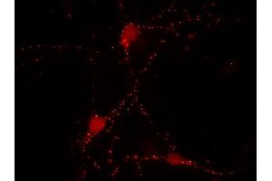 Indirect immunolabeling of cultured rat hippocampus neurons (dilution 1 : 500) (SYN2 Antikörper  (AA 440-458))