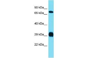 Host:  Rabbit  Target Name:  Prrxl1  Sample Type:  Rat Liver lysates  Antibody Dilution:  1. (DRGX Antikörper  (N-Term))