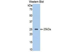 Western Blotting (WB) image for anti-serpin Peptidase Inhibitor, Clade A (Alpha-1 Antiproteinase, Antitrypsin), Member 10 (SERPINA10) (AA 278-425) antibody (ABIN1860973) (SERPINA10 Antikörper  (AA 278-425))