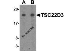 Western Blotting (WB) image for anti-TSC22 Domain Family, Member 3 (TSC22D3) (N-Term) antibody (ABIN1077436)