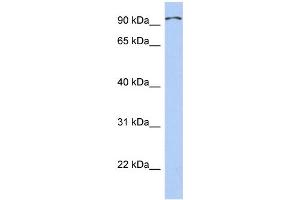 WB Suggested Anti-TRPC4AP Antibody Titration: 0. (TRPC4AP Antikörper  (Middle Region))