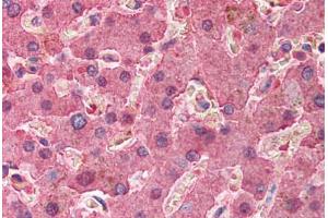 Human Liver (formalin-fixed, paraffin-embedded) stained with SERPINA1 antibody ABIN214380 at 2. (SERPINA1 Antikörper)