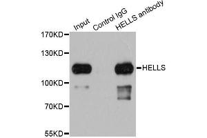 Immunoprecipitation analysis of 200 μg extracts of 293T cells using 1 μg HELLS antibody (ABIN5973444). (HELLS Antikörper)