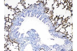 Immunohistochemistry (IHC) image for anti-Periostin (POSTN) (AA 577-810) antibody (ABIN5519054)