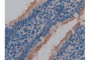 Immunohistochemistry (IHC) image for anti-Heparanase (HPSE) (AA 40-188) antibody (ABIN7437449)