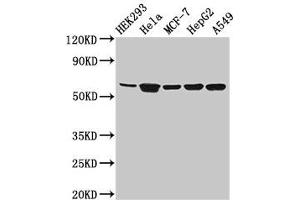 Western Blot Positive WB detected in: HEK293 whole cell lysate, Hela whole cell lysate, MCF-7 whole cell lysate, HepG2 whole cell lysate, A549 whole cell lysate All lanes: CYP4F22 antibody at 3. (CYP4F22 Antikörper  (AA 413-507))