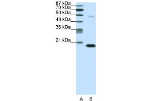 WB Suggested Anti-CBX3 Antibody Titration:  0. (CBX3 Antikörper  (Middle Region))