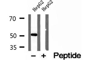 Western blot analysis of extracts of HepG2 cells, using NAPRT1 antibody. (NAPRT1 Antikörper  (Internal Region))