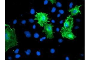 Anti-CNN2 mouse monoclonal antibody (ABIN2455129) immunofluorescent staining of COS7 cells transiently transfected by pCMV6-ENTRY CNN2 (RC221104). (CNN2 Antikörper)