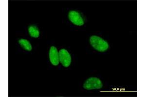 Immunofluorescence of purified MaxPab antibody to BCCIP on HeLa cell. (BCCIP Antikörper  (AA 1-314))