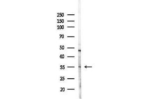 Western blot analysis of lysates from HepG2 cells(LPS, 4h treatment), using C1QTNF9B Antibody at 1/1000 dilution. (C1QTNF9B Antikörper)