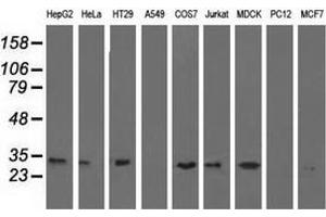 Western blot analysis of extracts (35 µg) from 9 different cell lines by using anti-ERCC1 monoclonal antibody. (ERCC1 Antikörper)