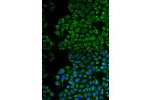 Immunofluorescence analysis of U2OS cell using TYR antibody. (TYR Antikörper)