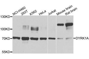 Western blot analysis of extracts of various cell lines, using DYRK1A antibody. (DYRK1A Antikörper  (AA 624-763))
