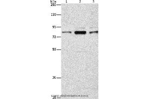 Western blot analysis of Human brain malignant glioma tissue, A172 and 293T cell, using ARHGEF7 Polyclonal Antibody at dilution of 1:800 (ARHGEF7 Antikörper)