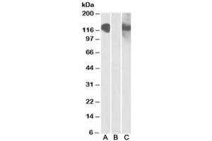 Western blot testing of HEK293 lysate overexpressing CDH11-MYC with CDH11 antibody [1ug/ml] in Lane A and with anti-MYC [1/1000] in lane C. (OB Cadherin Antikörper)