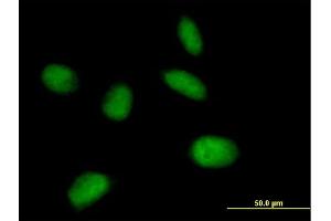 Immunofluorescence of purified MaxPab antibody to MIS12 on HeLa cell.