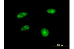 Immunofluorescence of purified MaxPab antibody to APTX on HeLa cell.