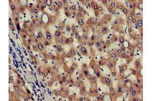 Immunohistochemistry of paraffin-embedded human liver tissue using ABIN7155985 at dilution of 1:100 (Hydroxyacid Oxidase 2 (HAO2) (AA 2-200) Antikörper)