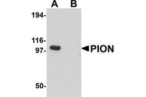 Western blot analysis of PION in EL4 cell lysate with PION antibody at 0. (GSAP Antikörper  (C-Term))
