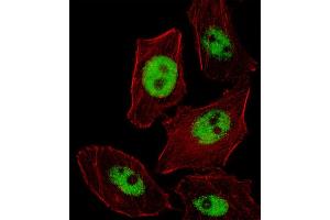 Fluorescent image of  cell stained with PHOX2B Antibody (Center) (ABIN655288 and ABIN2844878).