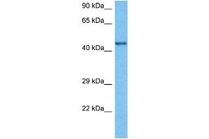 Western Blotting (WB) image for anti-Cholinergic Receptor, Nicotinic, beta 2 (Neuronal) (CHRNB2) (N-Term) antibody (ABIN2792252)